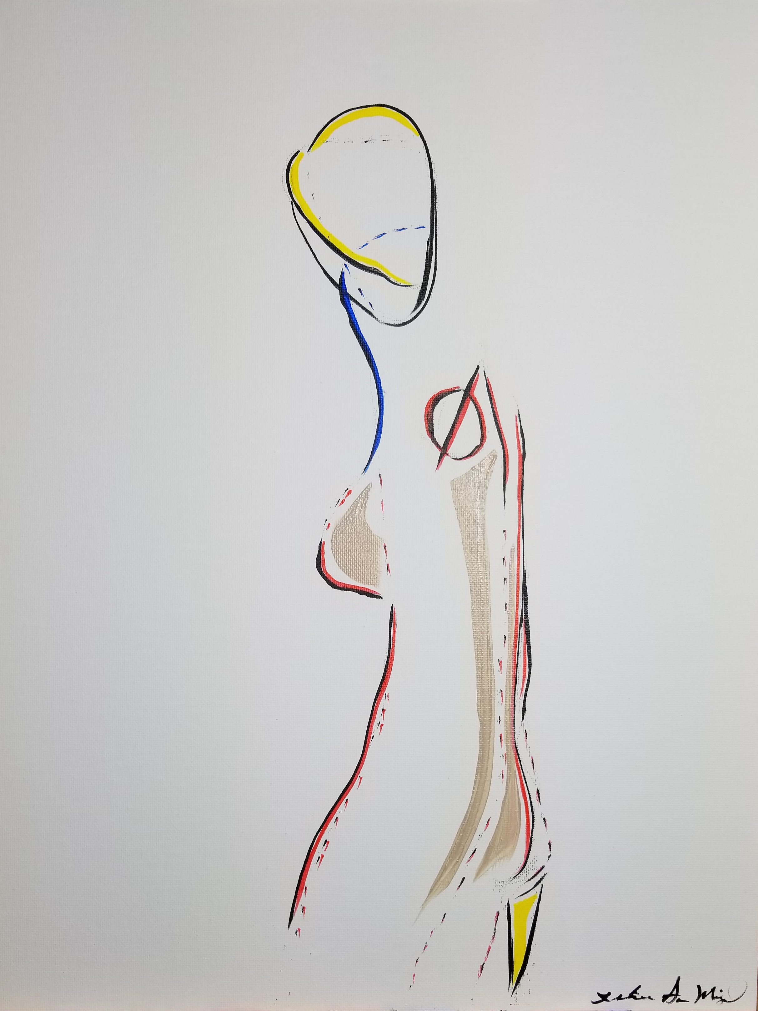 Prosthesis 